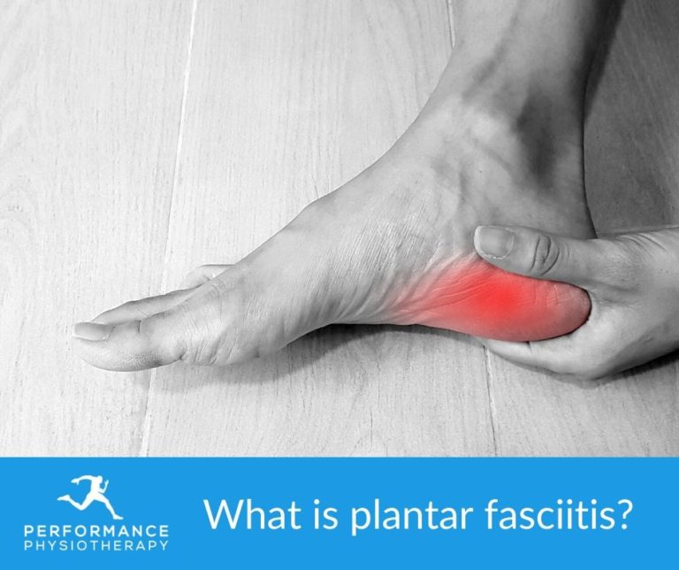 What is Plantar Fasciitis? - Physiotherapy Jersey